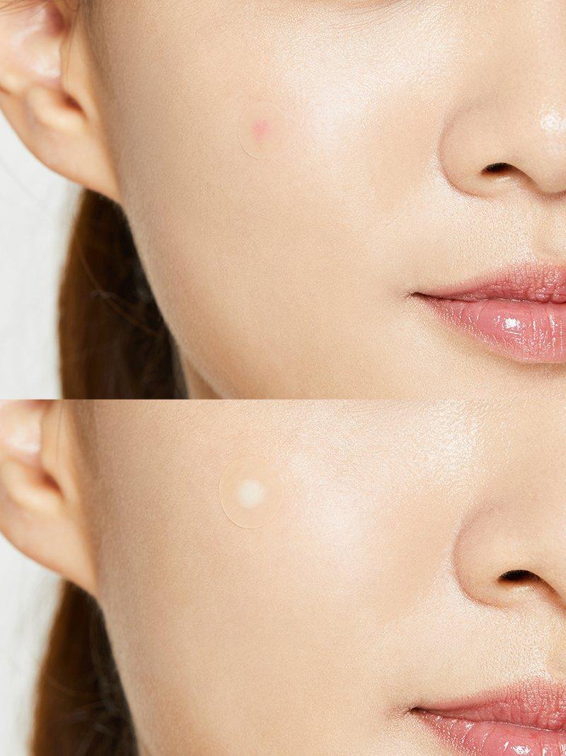 COSRX Acne Pimple Master Patch 24 patches - Image 2