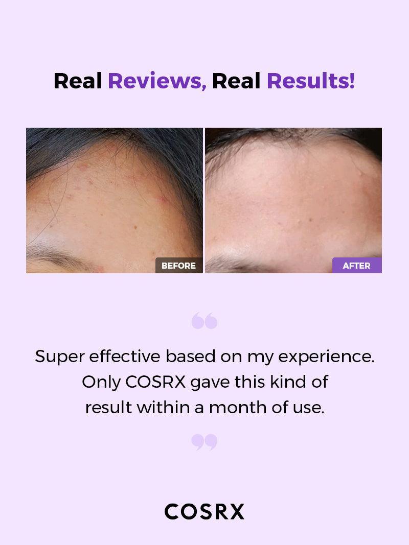 Cosrx AHA/BHA Clarifying Treatment Toner 50ml - Image 6