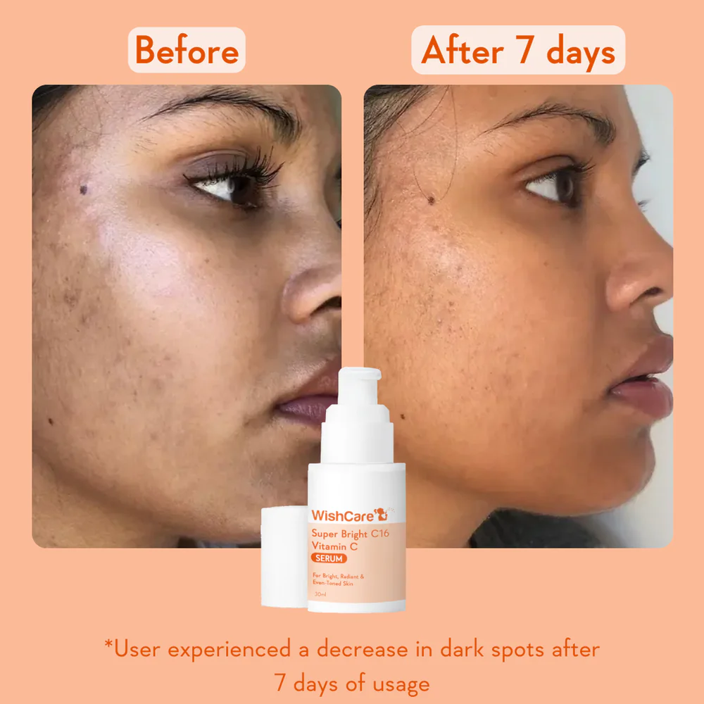WishCare Super Bright C16 Vitamin C Serum 30ml - Image 7