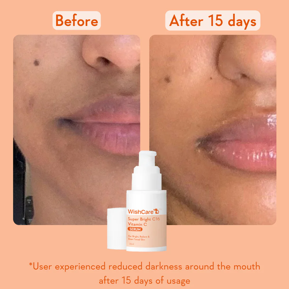 WishCare Super Bright C16 Vitamin C Serum 30ml - Image 6