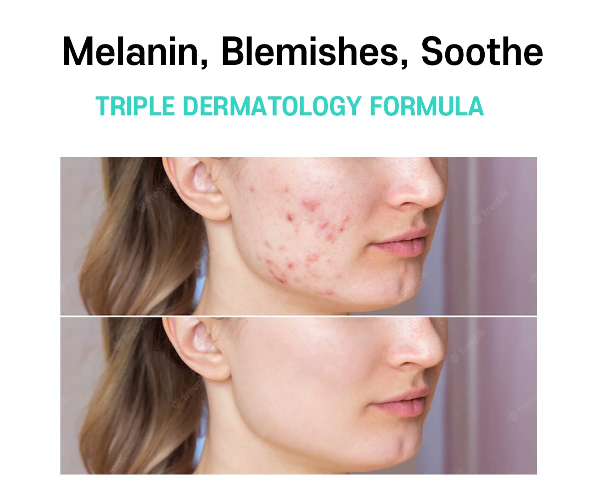 Care:Nel Anti Melasma Cica Cream 40ml - Image 8