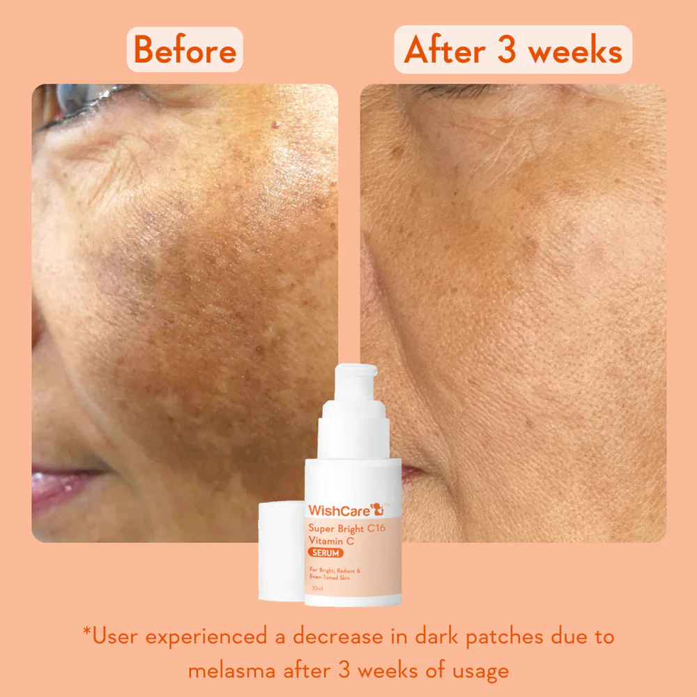 WishCare Super Bright C16 Vitamin C Serum 30ml - Image 5