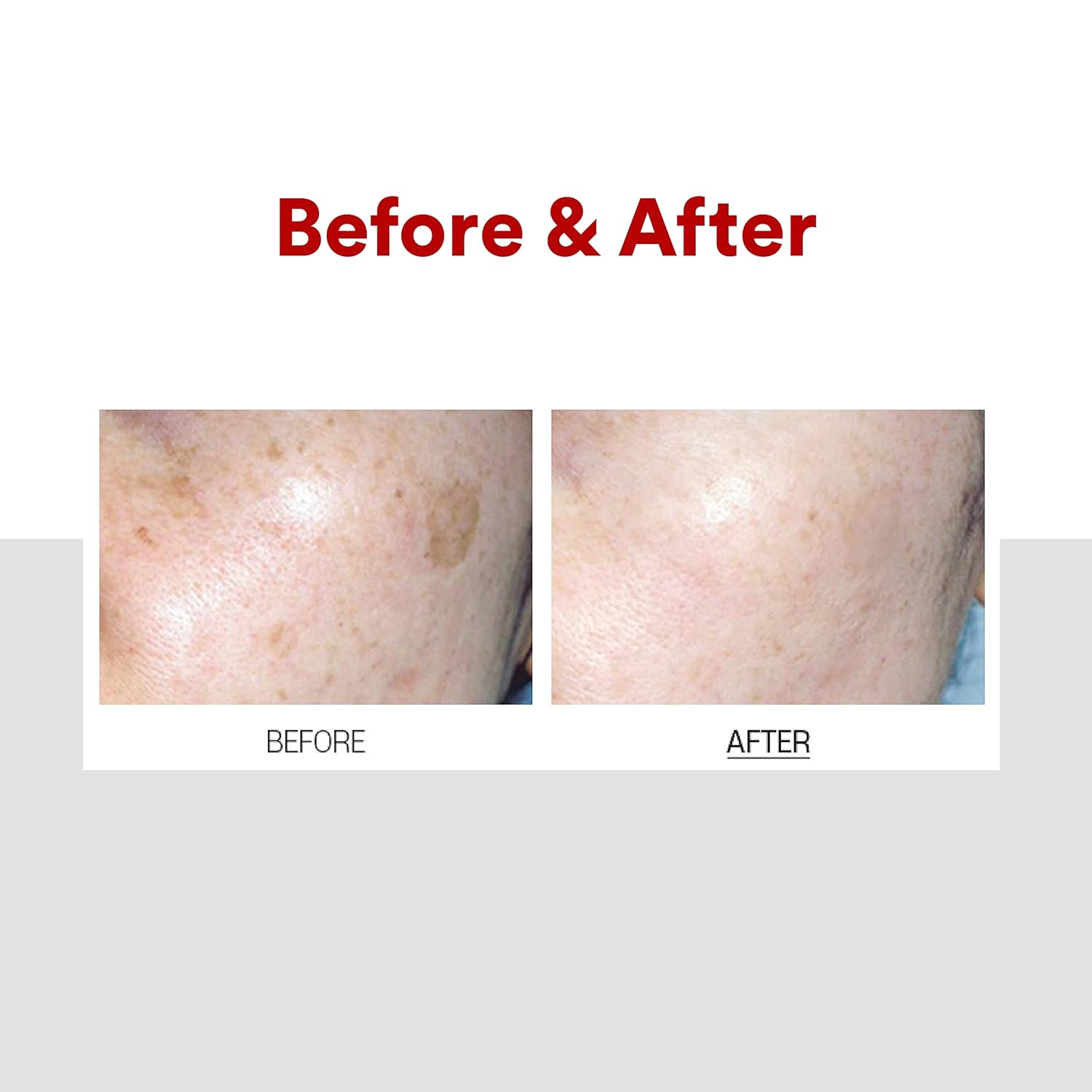 Medi Peel Melanon X Cream 30ml - Image 2