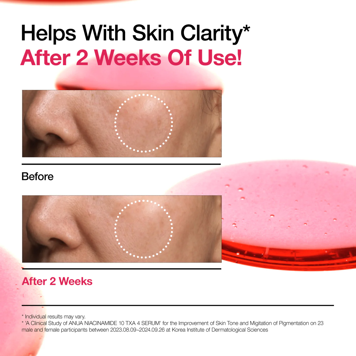 Anua Niacinamide 10% + TXA 4 Serum 30ml - Image 5