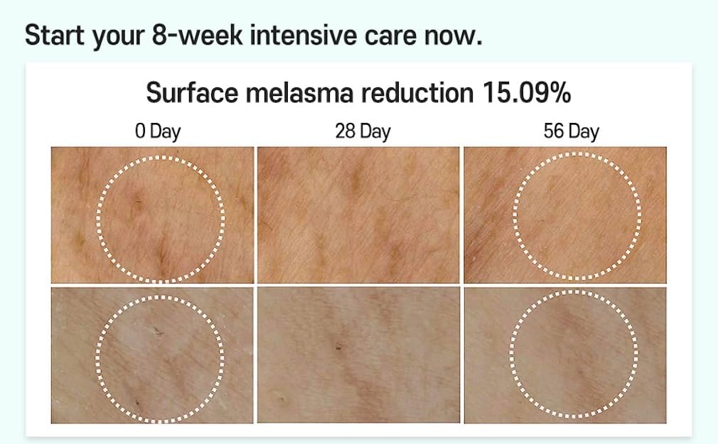 Care:Nel Anti-Melasma Cica Intensive Serum 30ml - Image 2