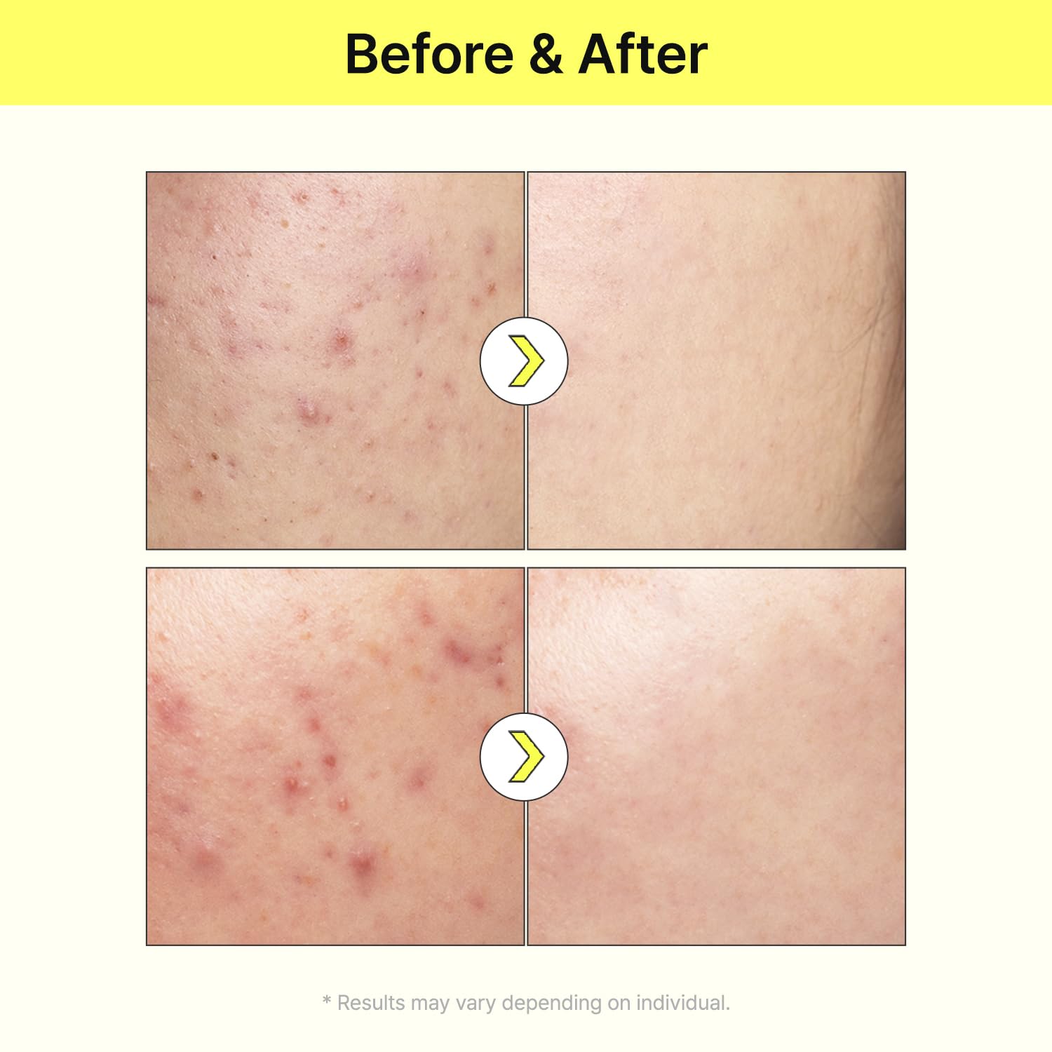 Tiam Vita B3 Source Niacinamide Serum 40ml - Image 8
