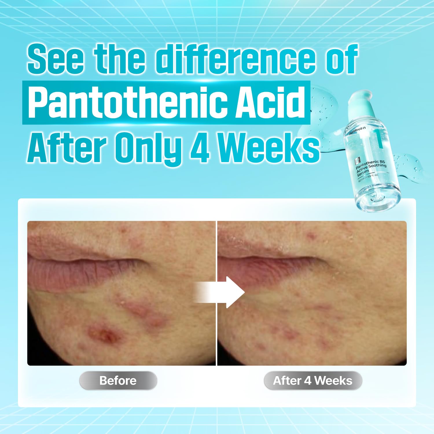 Numbuzin No.1 Pantothenic B5 Active Soothing Serum 50ml - Image 7