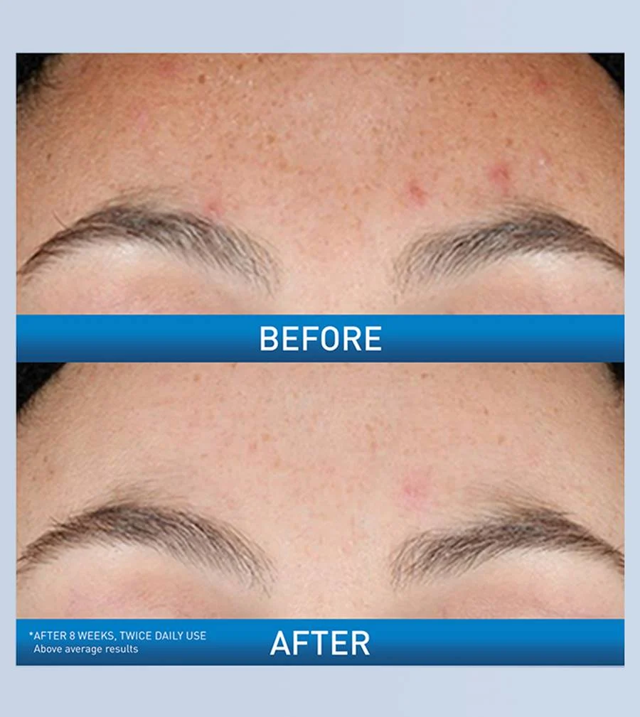 CeraVe Resurfacing Retinol Serum 30ml - Image 3