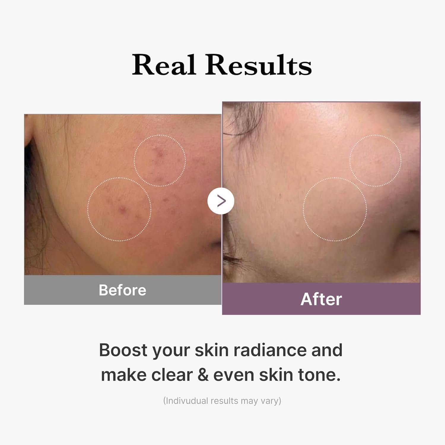 Medicube Age-R Glutathione Glow Toner 140ml - Image 5