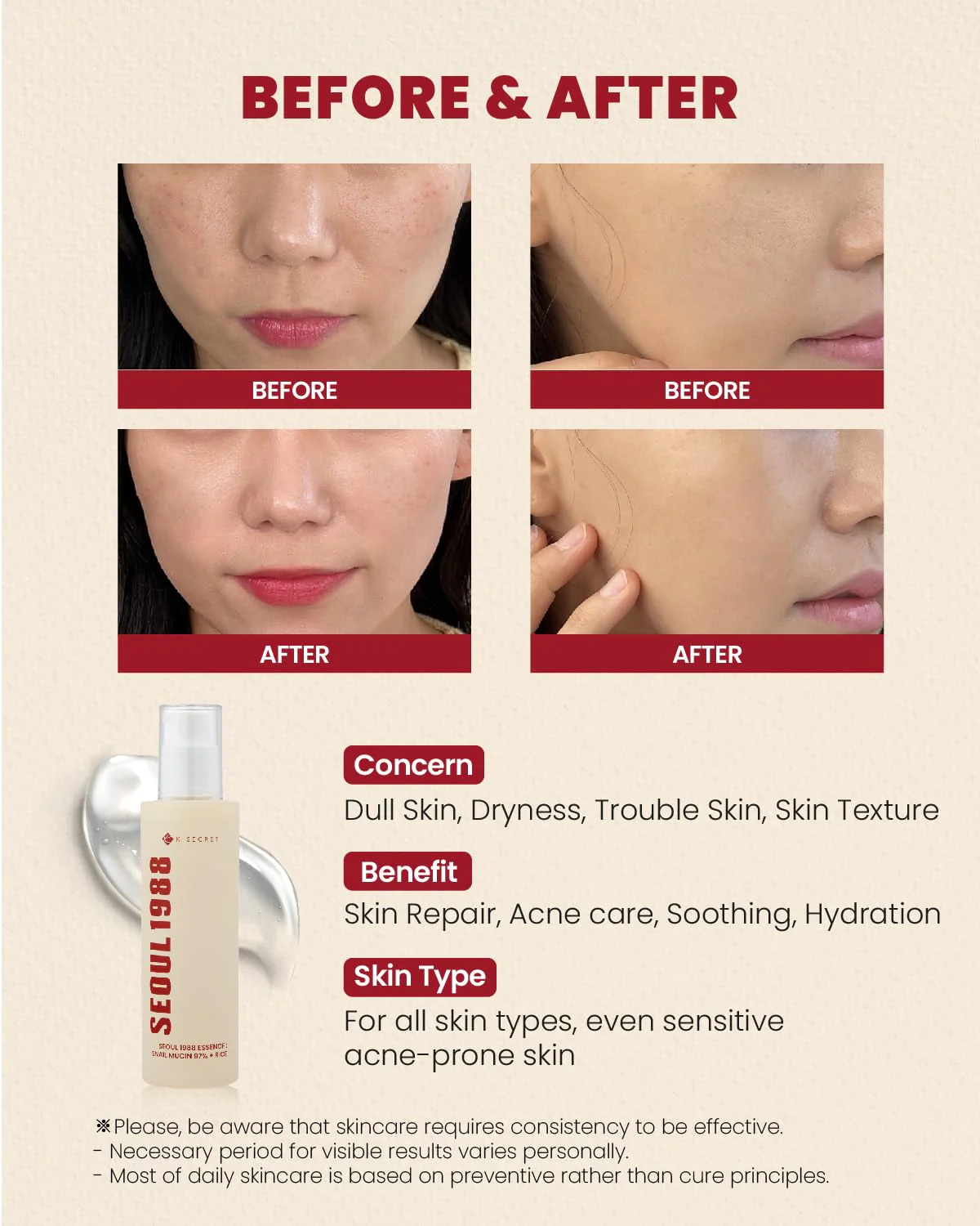 K-Secret Seoul 1988 Essence: Snail Mucin 97% + Rice 100ml - Image 2
